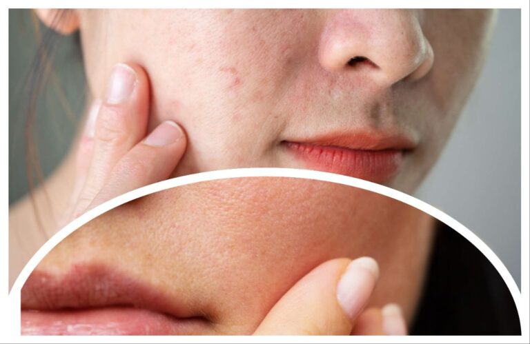 त्वचेची, अवांतर, मराठीकथा, मराठीलेखक, मराठीसाहित्य, Skin, DrySkin, OilySkin, कोरडीत्वचा, तेलकटत्वचा