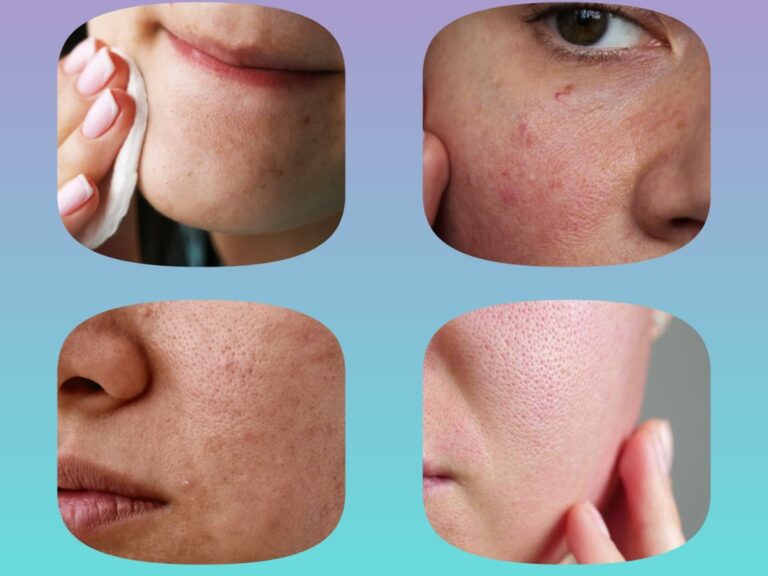 अवांतर, मराठीकथा, मराठीलेखक, मराठीसाहित्य, मराठीआर्टिकल, combinationskin, SkinProducts, Cleansing, Toning, Moisturizing, कोरडीत्वचा, क्लिनझिंग, टोनिंग, मॉश्चरायझिंग, मिश्रत्वचा, SensitivSkin,