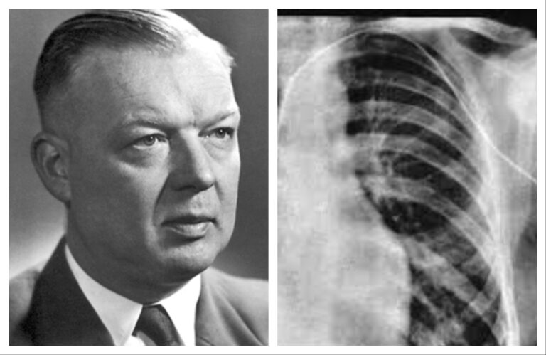 अवांतर, मराठीकथा, मराठीलेख, मराठीआर्टिकल, मराठी साहित्य, मी मराठी, अभिजात मराठी, डॉक्टर वार्नर फार्समन, आपल्या जीवाशी खेळणारा फार्समन, कार्डिॲक कॅथेटरायझेशन, नोबेल विजेता वार्नर फार्समन