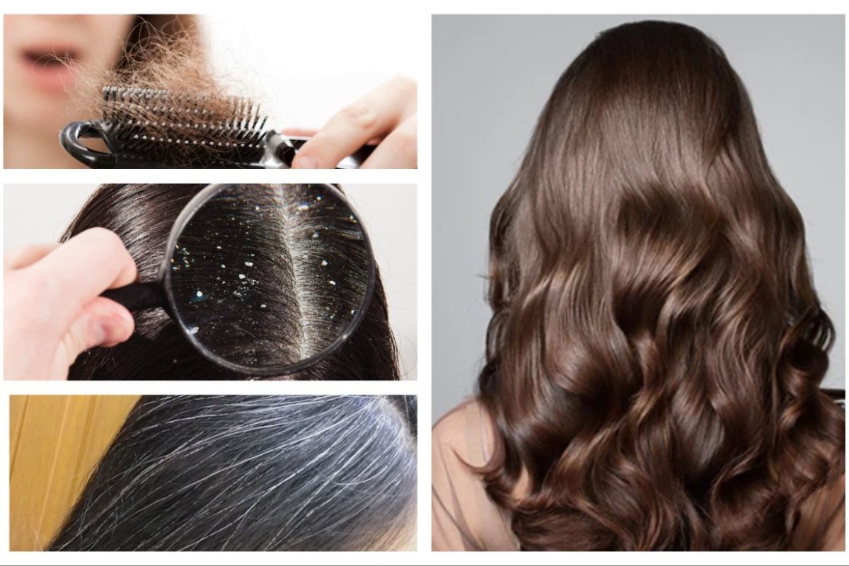 अवांतर, मराठीआर्टिकल, केसांची निगा, हेअर केअर, केस गळणे, केसात कोंडा, चाई, पांढरे केस, शॅम्पू,