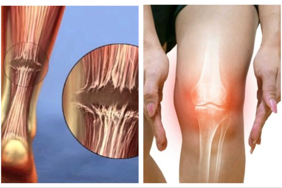 अवांतर, मराठी कथा, मराठी साहित्य, मराठी लेखक, मी मराठी, मराठी लेख, अभिजात मराठी, टेंन्डो एकियालीस, एसीएल, पोटरीखाली घोडशीर,