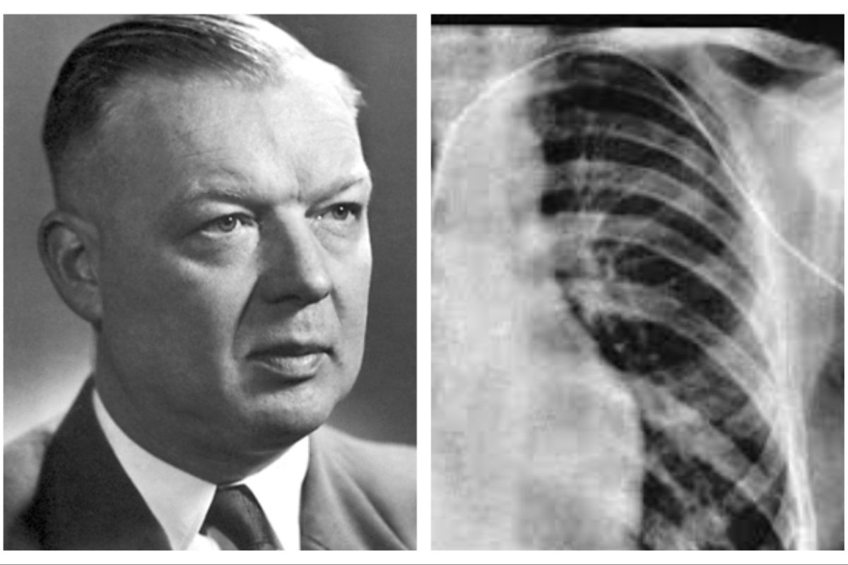 अवांतर, मराठीकथा, मराठीलेख, मराठीआर्टिकल, मराठी साहित्य, मी मराठी, अभिजात मराठी, डॉक्टर वार्नर फार्समन, आपल्या जीवाशी खेळणारा फार्समन, कार्डिॲक कॅथेटरायझेशन, नोबेल विजेता वार्नर फार्समन